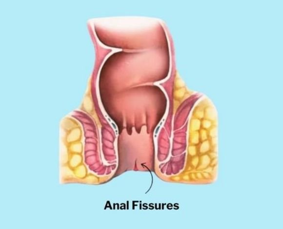 Non-Surgical Treatments