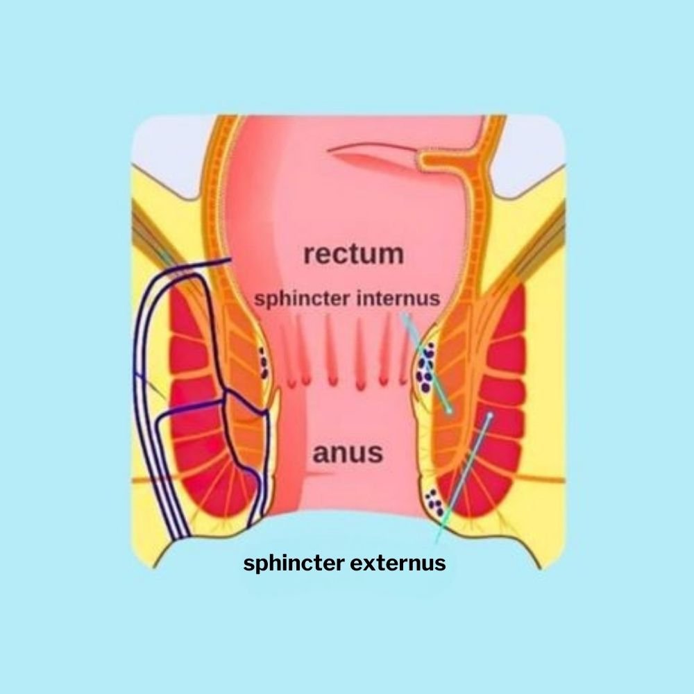 Anal Fistula