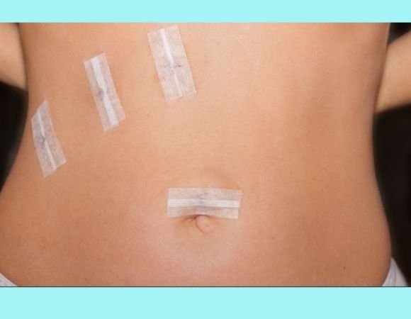 Recovery after gallbladder surgery