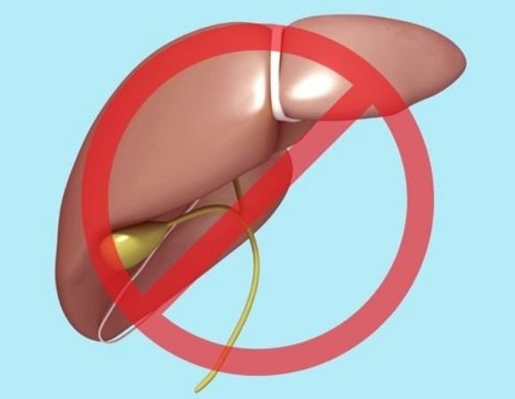 Living Without a Gallbladder