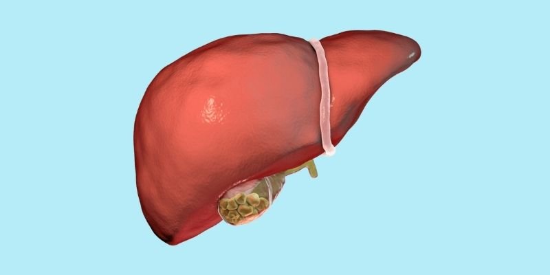 Laparoscopic Gall Bladder Surgery Banner