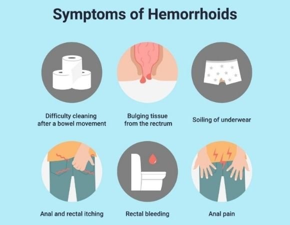 Symptoms of Piles