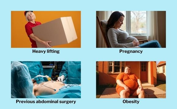 Causes of Hernia