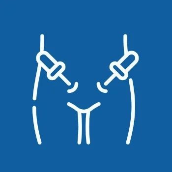 Laparoscopic Surgery