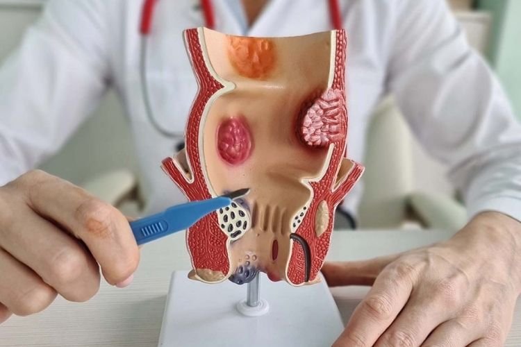 Anorectal Surgery