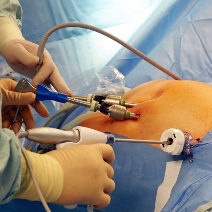 Potential Risks and Complications