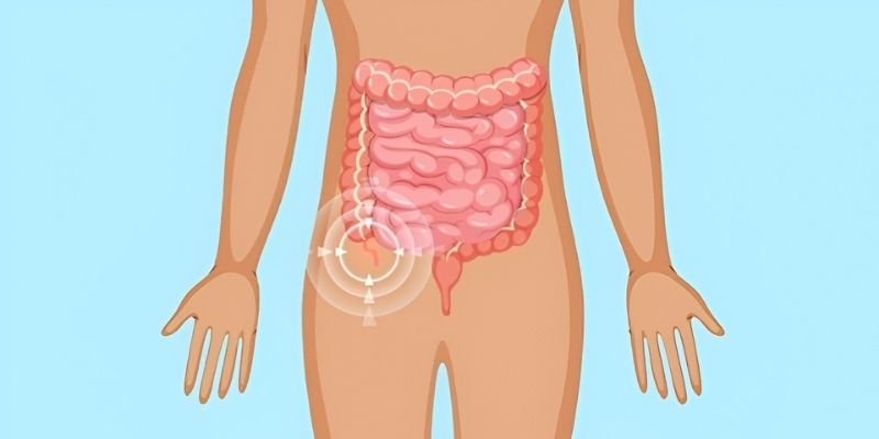 Laparoscopic Appendix Surgery Banner