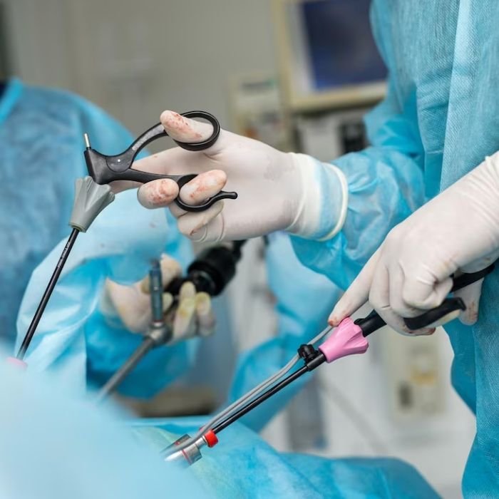 Benefits of Laparoscopic Surgery