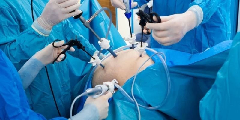 Laparoscopic Surgery Banner