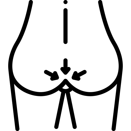 Anal Fissure