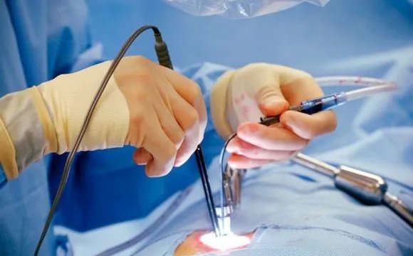 Laser surgery as a treatment