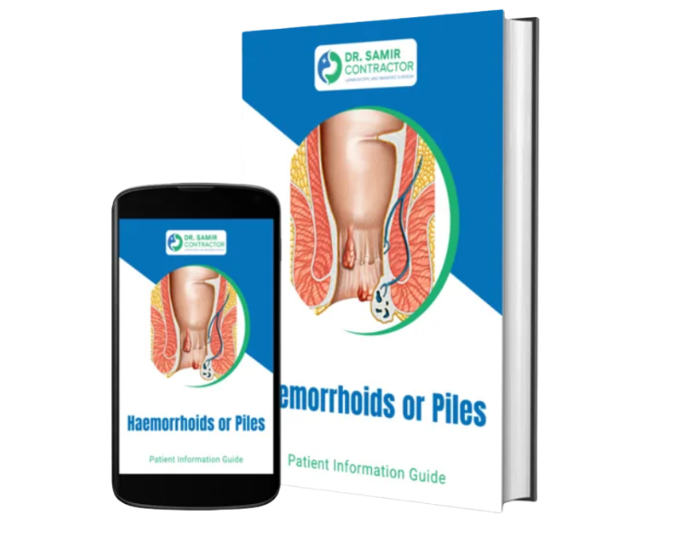 Hemorrhoids / Piles Ebook Mockup