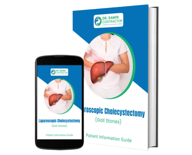 Laparoscopic Surgery Ebook Mockup